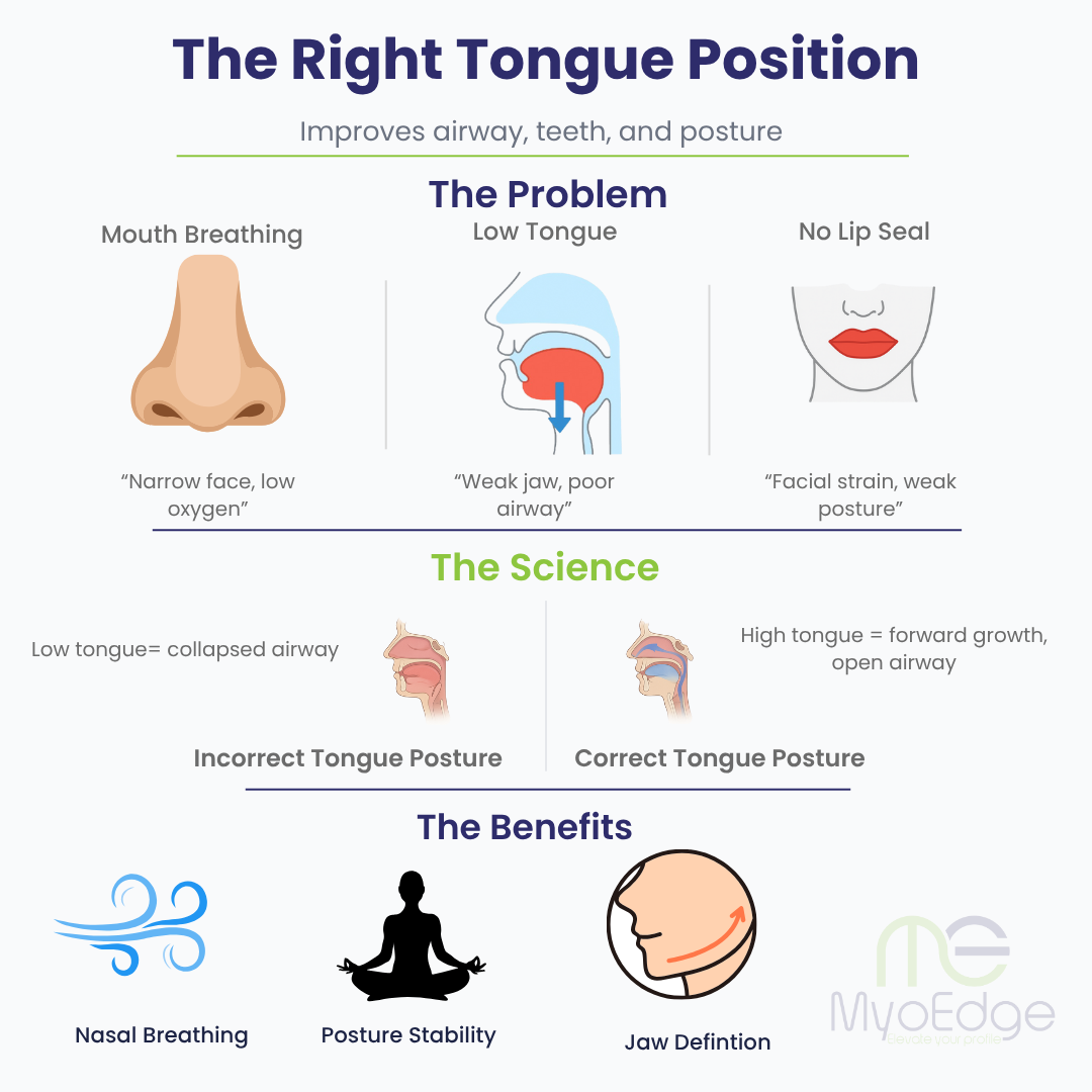 MyoEdge Tongue Positioner™