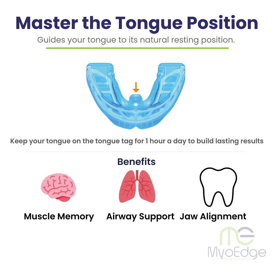 MyoEdge Tongue Positioner™