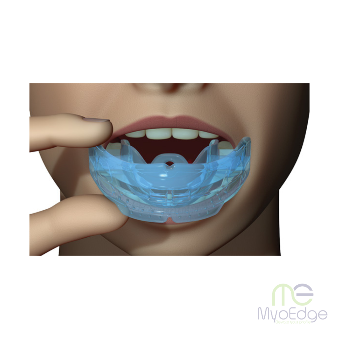 MyoEdge Tongue Positioner™