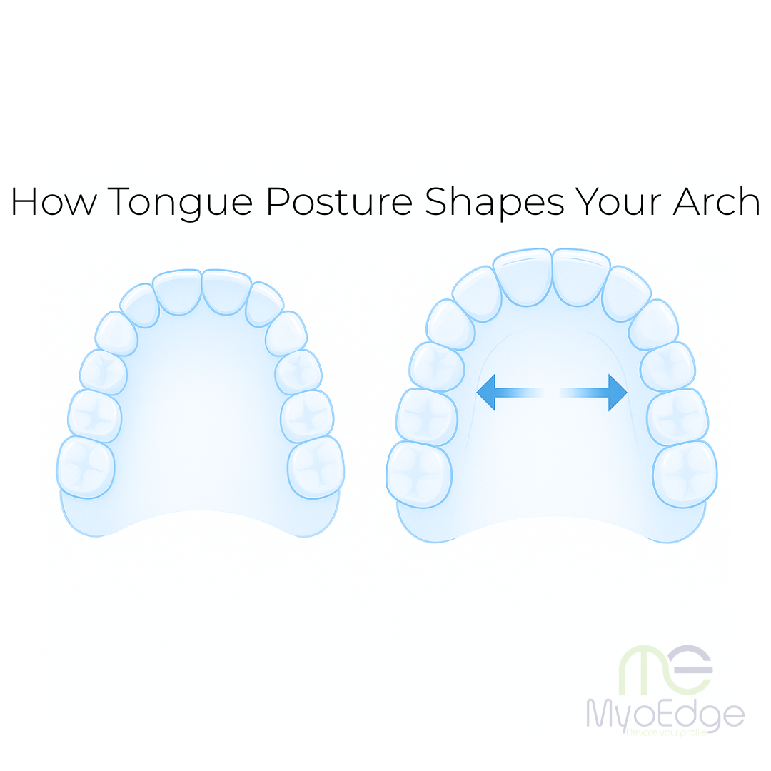 MyoEdge Tongue Positioner™
