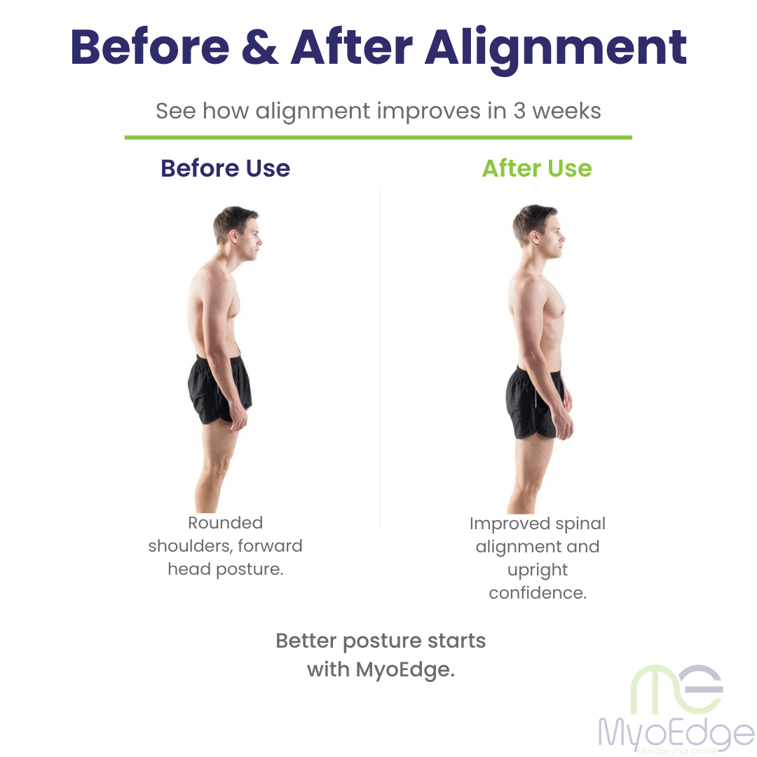 MyoEdge CoreCorrect™